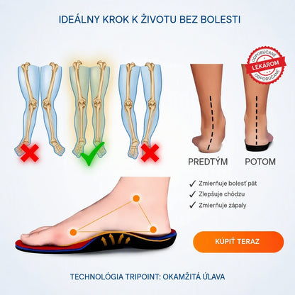 Posledný deň! Zľava 50 %! ✅ Ortopedická zdravotná obuv navrhnutá špeciálne pre ľudí s problémami nôh na zmiernenie bolesti chrbta, kĺbov a chodidiel.