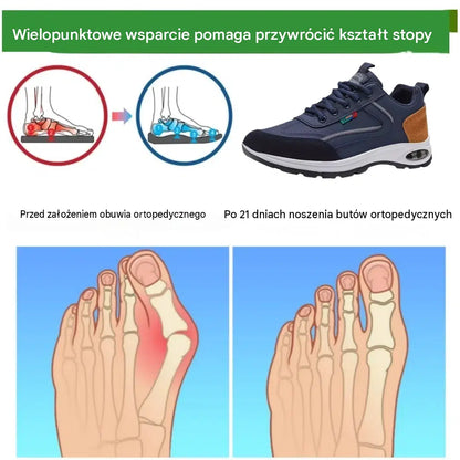 🎉Posledný deň! 50% zľava! ✅ Ortopedická obuv navrhnutá špeciálne pre ľudí s problémami s chodidlom, ktorá poskytuje oporu klenby a zmierňuje bolesti chrbta, kĺbov a chodidiel.