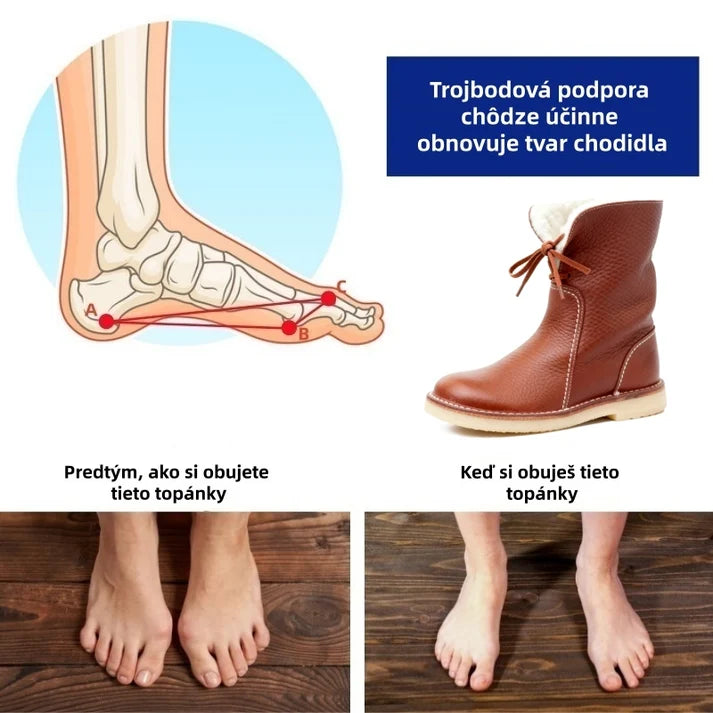 🎉 Dnešná špeciálna ponuka: 50% zľava - Nenechajte si to ujsť! ⏰ Ergonomicky navrhnutá ortopedická zimná obuv na úľavu od bolesti nôh, kolien a chrbta.