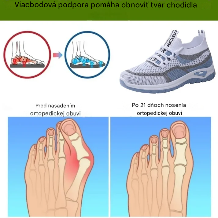 【🎁Posledný deň so zľavou 50%, nenechajte si to ujsť!】Ergonomická ortopedická obuv s podporou klenby✅️, vďaka ktorej bude chôdza bezbolestná👞